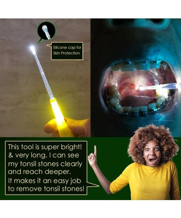 Airgoesin Professional Tonsil Stone Remover Tool with LED Light | Stainless Steel Tonsillolith Pick & Oral Care Irrigation Syringe | Yellow Tongue Cleaner Scraper - Buy Online on GoSupps.com