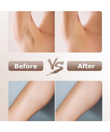 2023 3-in-1 IPL Hair Removal Device - Permanent Painless Laser for Men & Women | 9 Energy Levels Face Body Armpits Legs - Buy Online on GoSupps.com