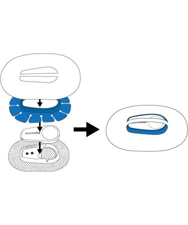 Blue G6 Shield for Dexcom Over Patches | Reusable & Washable Diabetic Accessory - Buy Online on GoSupps.com