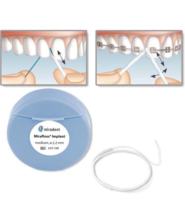Buy Miradent Mirafloss Implant Tooth Flap Medium ( 2.2 mm) Ideal for Cleaning Implants & Bridges Shipping Worldwide - Buy Online on GoSupps.com