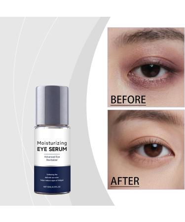 S rum hydratant et claircissant pour les yeux l'acide hyaluronique traitement anti- ge pour les yeux cr me anti-rides pour les cernes poches et poches sous les yeux r duit les ridules (6PCS) - Buy Online on GoSupps.com