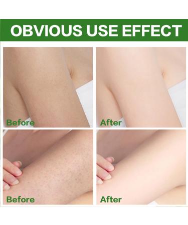  Besstoil 100% Organic Himalayan Body Scrub Rich in Natural Minerals Suitable for All Skin 250g (Green Tea) - Buy Online on GoSupps.com