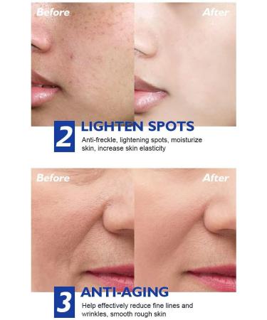 Retinol Cream for Face Face Moisturizer with 2.5% Retinol Hyaluronic Acid Anti-Aging Moisturizer for Face & Neck Wrinkle Reducer for All Skin Types - Buy Online on GoSupps.com