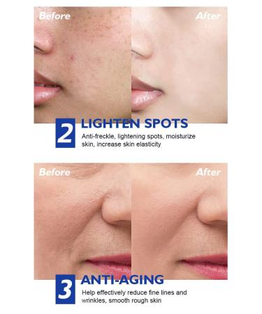 Retinol Cream for Face - 2.5% Retinol & Hyaluronic Acid Anti-Aging Moisturizer for All Skin Types - Buy Online on GoSupps.com
