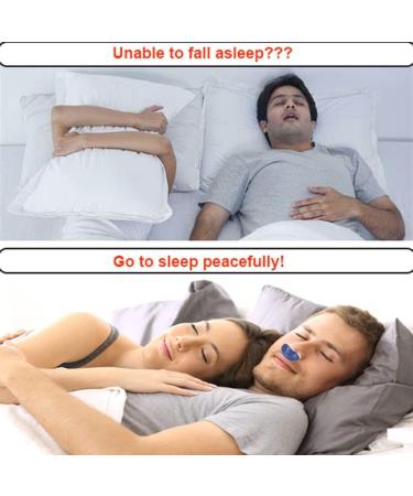 XUEMEIZI Hoseless Anti Snoring Device - Wind Speed Snoring Solution for Men and Women - Nasal Dilator Nose Vents Plugs - Buy Online on GoSupps.com