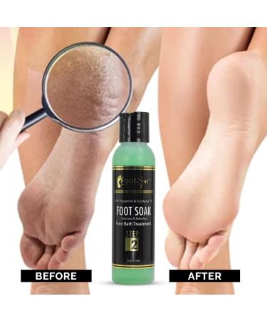 FOOT SPA: Eucalyptus & Peppermint Foot Soak - Cleanses Softens & Refreshes 4 Oz | International Shipping Available - Buy Online on GoSupps.com