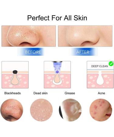 Electric Blackhead Remover Vacuum - USB Rechargeable Pore Cleaner Kit with 5 Suction Heads | Blackhead Vacuum Extractor for Acne, Comedones, and Whiteheads - Buy Online on GoSupps.com