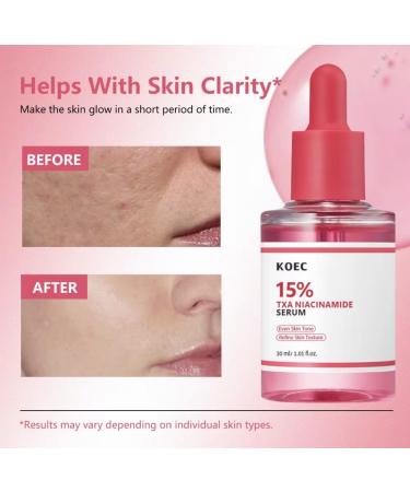 KOEC 15% TXA Niacinamide Facial Serum with Hyaluronic Acid Rose Extract Peptide Complex for Skin Tone and Texture 1.01 Fl Oz - Buy Online on GoSupps.com