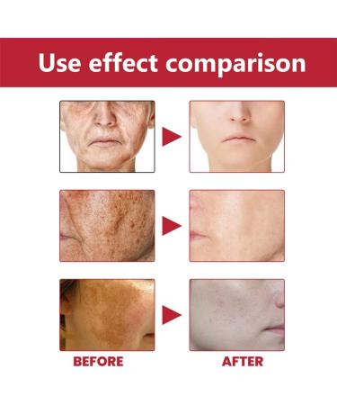 Allayu Women Face Whitening Brightening Serum Girls Facial Moisturizing Essence Portable Skin Care Stock Solution Beauty Supplies - Buy Online on GoSupps.com