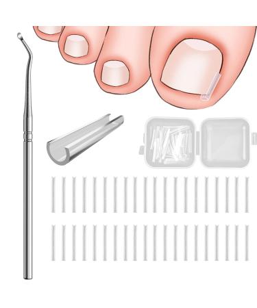 Ingrown Toenails Set Toenail Correction Patch Nail Clip Toenails Ingrown Toenails Toenail Correction with Lifter for Ingrown Toenails 40 Pieces
