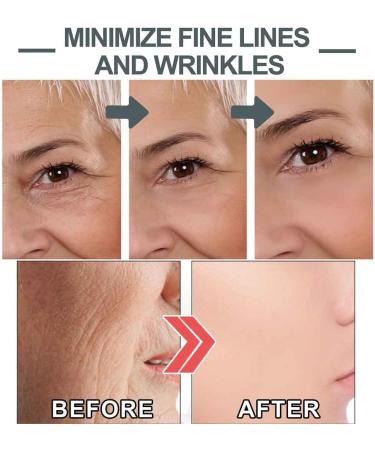  SBTRKT Voletas Collagen Boost Anti-Aging Serum Anti-Wrinkle and Brightening Skin Serum Advanced Anti-Wrinkle Serum Reduce Wrinkles Moisturizing Serum Face Serum with Vitamin C Dark Spot Corrector - Buy Online on GoSupps.com