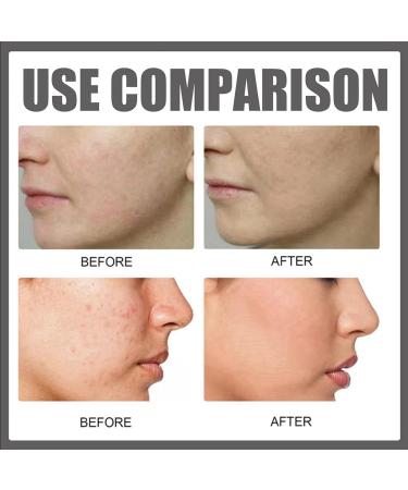 Face Moisturiser - Soothing & Barrier Support Serum Barrier Serum Skin Barrier Repair Cream Tightening Serum Serum Face Anti Redness Serum Facial Serum Face Moisturiser Serum Face Skincare Serum - Buy Online on GoSupps.com
