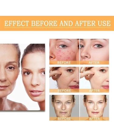 Glycolic Acid 7% Toning Resurfacing Solution -Glycolic Acid 7% Toning Resurfacing Solution for Blemishes and Acne Anti-Aging Freckle Removal Acne Tighten Pores 3bottles - Buy Online on GoSupps.com
