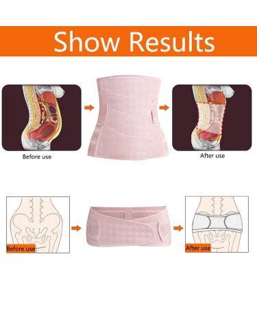 WANYI 4-Patch Postpartum Belly Wrap with Pelvis Belt - 2 in 1 C-Section Recovery Belt for Postpartum Support - White, Size L - Buy Online on GoSupps.com