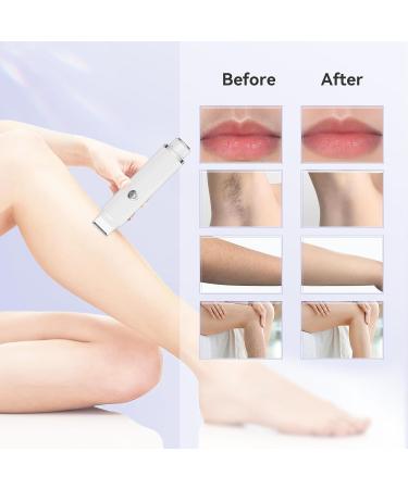 Razor Women 2-in-1 Intimate Electric Shaver | Waterproof IPX7 Trimmer for Bikini Zone | Wet & Dry Use - Buy Online on GoSupps.com