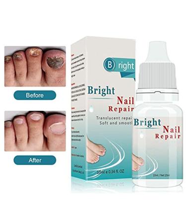 Bright Nail Repair | Best Toenail Fungus Treatment | 10 mL - Fast & Effective Infection Relief - Buy Online on GoSupps.com
