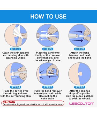 Skin Day Remover Kit - 40 Ligaments & 36 Repair Patches for Small to Medium Skin Tags - Buy Online on GoSupps.com