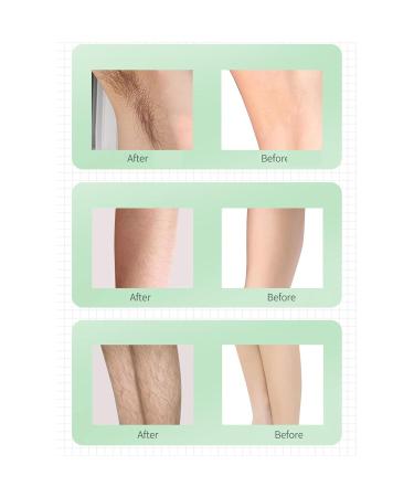 IPL Hair Removal Device - 990 000 Flashes 5 Adjustable Steps Photon Technology for Men & Women - Smooth Skin EU Connector - Buy Online on GoSupps.com