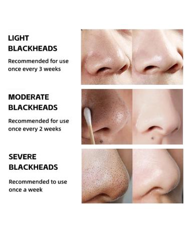 Tunbot Blackhead Removal Mask 120ML - Deep Clean Bamboo Charcoal Mask for Men & Women - Purify Pores & Remove Blackheads - Buy Online on GoSupps.com