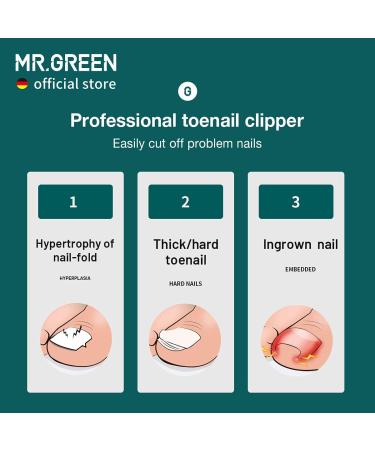 MR.GREEN Anti-Splash Toe Nail Clippers - Professional Pedicure Tool for Ingrown & Thick Nails - Blue Handle - Buy Online on GoSupps.com