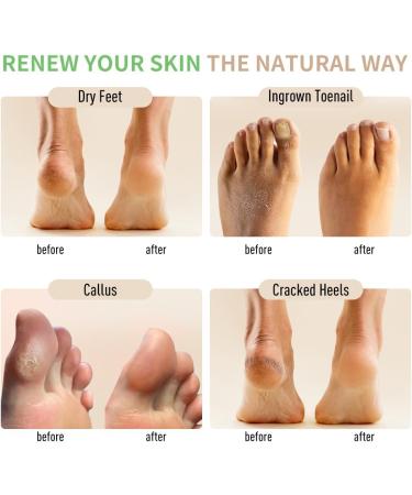 Natural Foot Soak Salt - Soothing Foot Treatment for Athlete's Feet Odor Relief & Itchiness - 9 oz - Buy Online on GoSupps.com