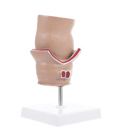 iplusmile Pathological Hemorrhoid Medical Model Teaching Medical Hemorrhoid Model