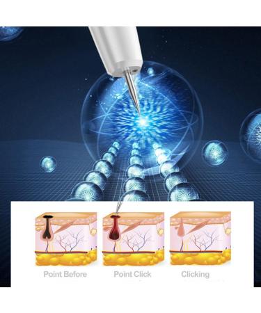 WhFKLca Plasma pen with 15 levels removal of moles warts dark spots black dots nevus freckles flat spots pimples skin tags safe and painless with display and light Gold - Buy Online on GoSupps.com