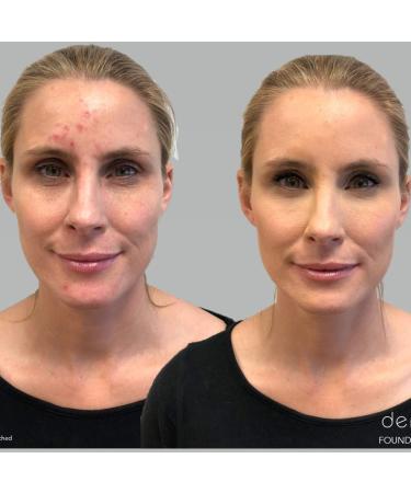 Dermaflage Color Correcting Palette for Dark Circles, Redness, Bruises & Dark Spots | 6.9g/.24oz - Buy Online on GoSupps.com