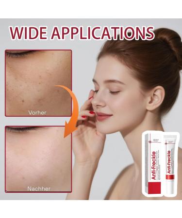 3 pi ces Cr me claircissante pour peau fonc e Cr me anti-taches de rousseur r duire les taches brunes Cr me For Les Mains L'acide Kojique Blanchissant Les Taches De Rousseur - Buy Online on GoSupps.com