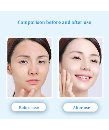 Ice Globes for Face & Eyes - Best Ice Roller Beauty Facial Tools (Blue) | Shop Internationally - Buy Online on GoSupps.com