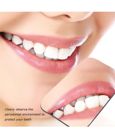 Scozia Intra Oral Mirror - Dental Photography Mirror for Precise Stomatoscope Imaging - Buy Online on GoSupps.com