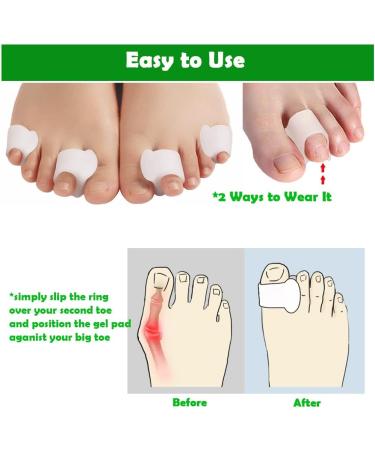 Gel Toe Separators for Bunions & Overlapping Toes - 8 Pack Hammer Toe Straightener, Pinky Toe Spacers, Bunion Corrector & Relief - White - Buy Online on GoSupps.com
