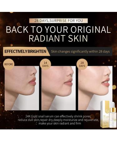 24K Mucin Snail Essence Snail Mucin Serum Face Moisturiser with Hyaluronic Acid Serum Niacinamide Serum Ginseng Extract Skincare for Hydrating Anti-Wrinkle Even Skin Tone - Buy Online on GoSupps.com