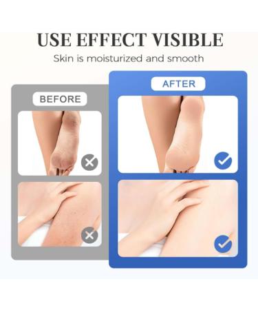  ZLHHRZJX Moisturizing and Anti-Crack Foot Cream with 60% Urea Foot Care Stick and Cream with Urea Heel Lotion Repairs Cracked Feet and Moisturizes Dry Feet (7 Pieces) - Buy Online on GoSupps.com