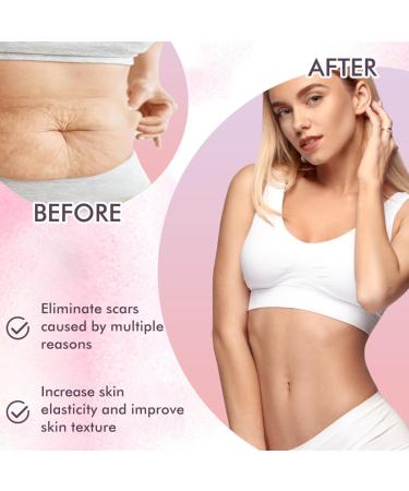 KARLOR Body Oil for Pregnancy Stretch marks Body Oils for Scars Pregnancy Stretch Mark Prevention Skin Care Oil Body Reduce streth makrs scars & Marks form pregnancy injury acne(120ml) - Buy Online on GoSupps.com