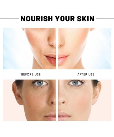 Acid Refining Serum Acid Delicate Essence 2% High-Strength Vitamin Minimises Pore Face Serum Pore Smoothing Fruit Acid Essence - Buy Online on GoSupps.com