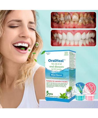 Oralheal Jelly Cup Mouthwash - Restore Teeth & Freshen Breath | 2PCs - Buy Online on GoSupps.com