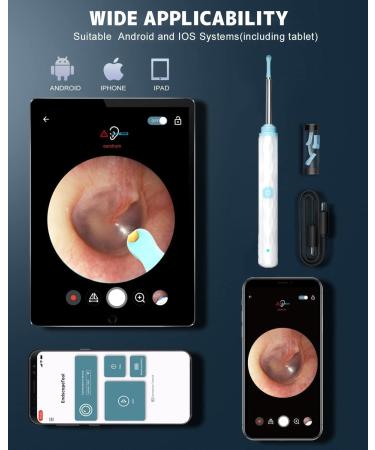 Ultimate Ear Wax Removal Kit with 1296P Camera Safe & Easy Ear Cleaner for iPhone iPad & Android - 9 Picks & 8 Tools Included - Buy Online on GoSupps.com