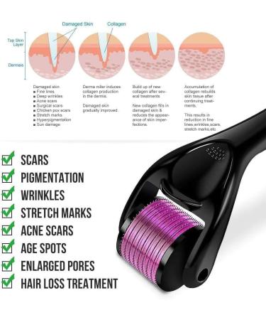 Derma Roller Beard Care Roller 1mm Titanium 540 Micro Needle Roller for Men and Women Microneedle Roller for Stimulate Hair Growth Facial Skin Care Anti Ageing Wrinkle Scar Removal Acne Spot - Buy Online on GoSupps.com