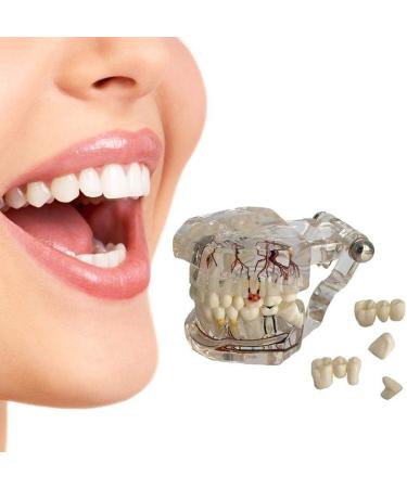 Model of Tooth Disorders Transparent Adult Teeth Dental Model of Teeth Tooth Removable Prosthetics Teeth Demonstration Model for Teaching Transparent