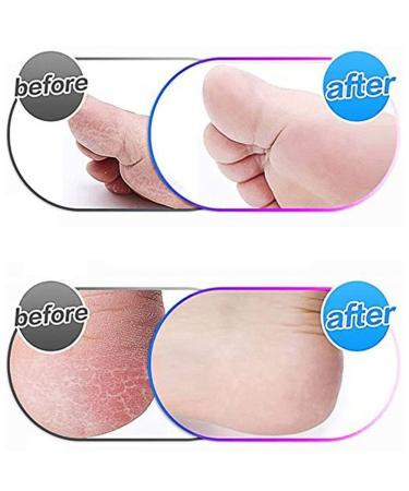 Buy HSTHE SEA 10 Pack Extra Rough Scholl Velvet Smooth Pedi Replacement Rolls - Black Roller Head Refills for Effective Corn Removal - Buy Online on GoSupps.com