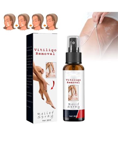 Vitiligo Relief Spray Vitiligo Skin Repair Spray Vitiligo Care Spray pour les soins de la peau Cr me apaisante et hydratante pour le psoriasis Spray apaisant pour le psoriasis