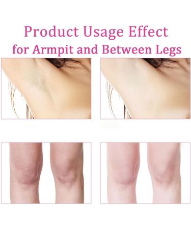 Underarm Evens Skin Tone Cream - Kojic Acid Underarm Products - Skincare Armpit Cream for Dark Skin - Underarm Care Cream - Body Cream for Dark Skin - Improve Skin and Reduce Odor - Buy Online on GoSupps.com