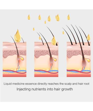 Hair Oil Applicator & Scalp Massager for Hair Growth - Essential Brush for Hair Treatment - White - Buy Online on GoSupps.com