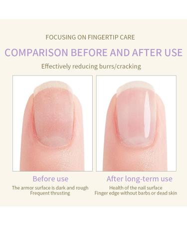 Cuticle Oil for Nails 7.5ml Nail Oil Nail Cuticle Oil with Jojoba Oil & Lavender Extract Nails Oil for Damage Nails Moisturizes Strengthen Nail Growth & Nail Repair Prevents Hangnails Cracked - Buy Online on GoSupps.com