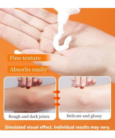 Intimate Area Dark Spot Corrector Cream - 2oz Niacinamide & Shea Butter for Underarm Neck Elbow Brighten & Smooth Rough Skin Upgraded Formula - Buy Online on GoSupps.com