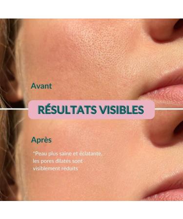 Facial Cleansing Kit with Organic Aloe Vera and Hyaluronic Acid - 150 ml Cleansing Gel and 150 ml Toner - Facial Care for Normal Combination and Impure Skin - Buy Online on GoSupps.com