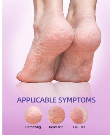 4 Pairs Foot Peel Mask Skin Exfoliating Foot Masks Cracked Feet Callus Dead Skin Remover - Feet Peeling Mask for Soft Feet Scent of Lavender (L count 4) L 4.0 - Buy Online on GoSupps.com