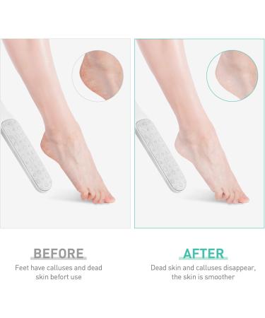Foot File Double-Sided Hard Dead Skin Remover Stainless Steel Foot File Rasp Heel Peel Foot Scrubber Feet Pedicure Callus Remover for Wet and Dry Cracked Feet White - Buy Online on GoSupps.com