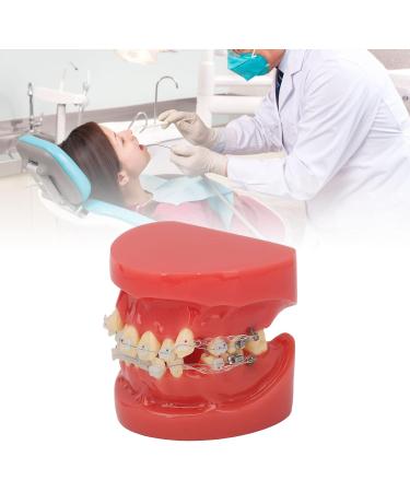 Orthodontic Ceramic Demonstration Model - 24 Teeth with Wires & Bracket for Overcrowding Painting & Jaw Opening - Buy Online on GoSupps.com